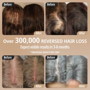 Breo - Hair Result Before and After